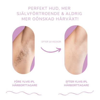 LysaSkin™ – Smärtfri släthet, varaktigt självförtroende