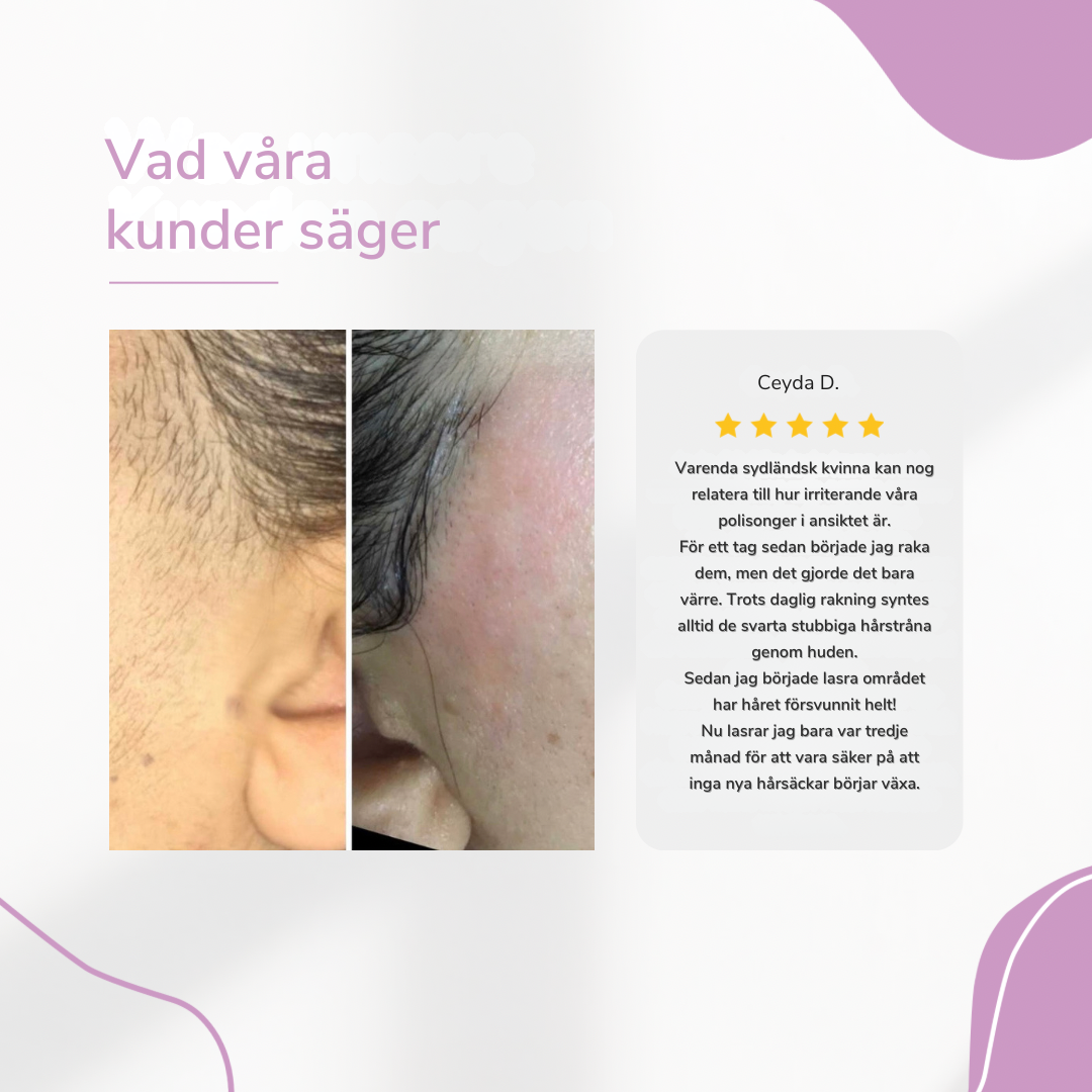 LysaSkin™ – Smärtfri släthet, varaktigt självförtroende