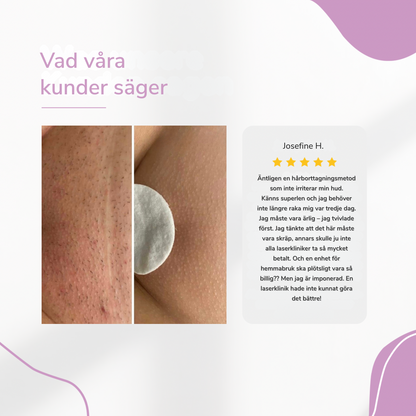 LysaSkin™ – Smärtfri släthet, varaktigt självförtroende